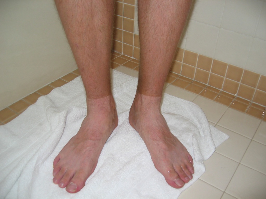 Needed more sunblock/