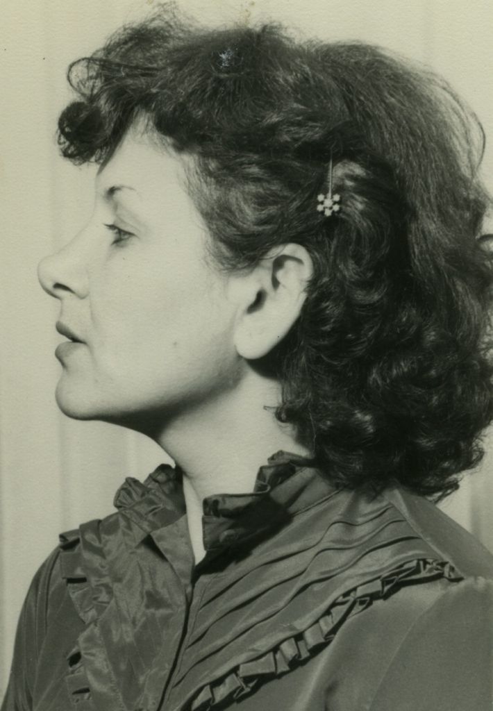 Fara after the nose job!/