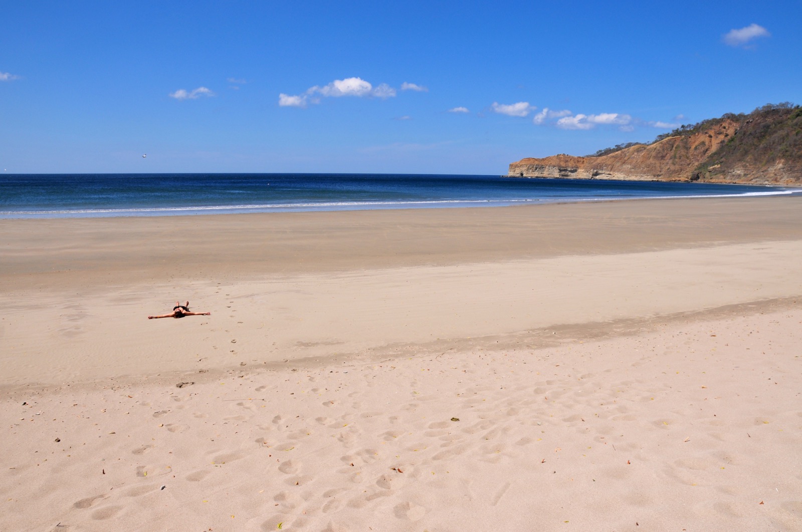 How sunburns happens/