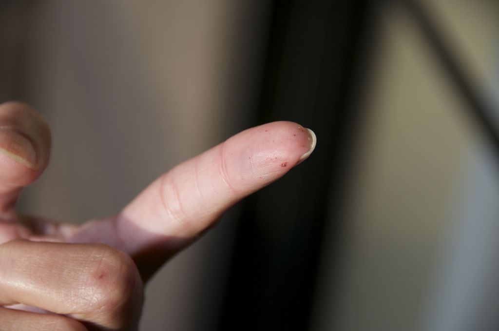 Dan to the rescue! /